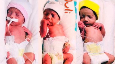 Nacieron trigemelas genéticamente idénticas