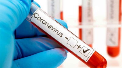 Reportaron 355 casos de coronavirus en quince departamentos: Paraná sumó 140