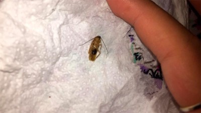 Insólito: Le sacaron una cucaracha del oído