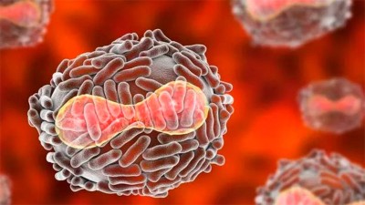 Sexto caso de viruela del mono en Argentina: la persona reside en Córdoba