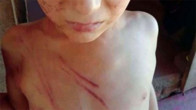 Madre golpeó brutalmente a su hijito para disciplinarlo: vecinos lo rescataron