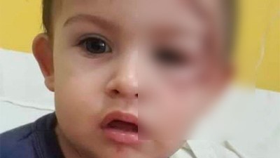 Padres arrojaron de moto a niño y se fugaron: el pequeño tenía cocaína en sangre