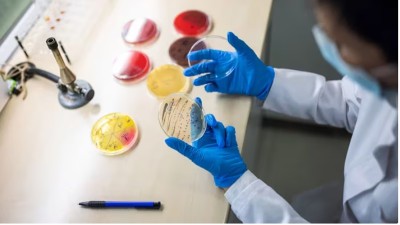 Día de la lucha contra el Síndrome Urémico Hemolítico: 9 claves para prevenir la enfermedad