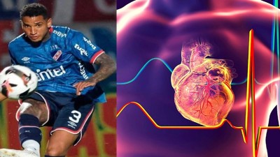 Arritmia cardíaca: cómo reconocer el trastorno que le costó la vida al futbolista Juan Izquierdo