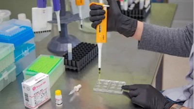 Aumento de casos de sífilis: La importancia de los testeos para descartar la infección