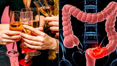 Relacionan el consumo excesivo de alcohol con aumento de cáncer en adultos jóvenes