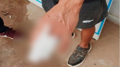 Delincuente sufrió cortes en los dedos mientras robaba en una casa