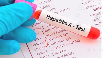 Brote de Hepatitis A: son 12 las provincias afectadas y revelan cuántos casos hay