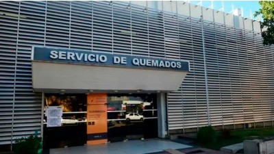 Adolescente sufrió quemaduras en el 60 por ciento del cuerpo al explotarle el celular