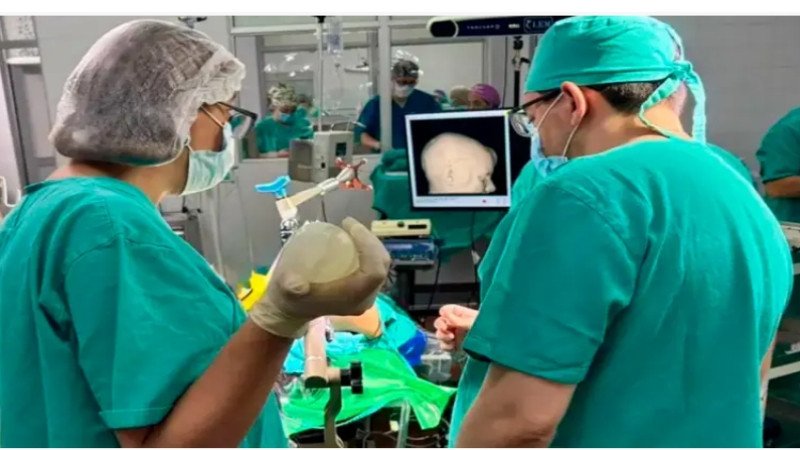 Cirugía inédita en hospital público: usaron un GPS cerebral para extraer dos abscesos a una adolescente