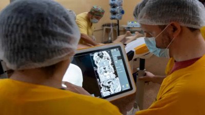 Operaron un tumor cerebral con una tecnología similar al GPS que guía a los cirujanos
